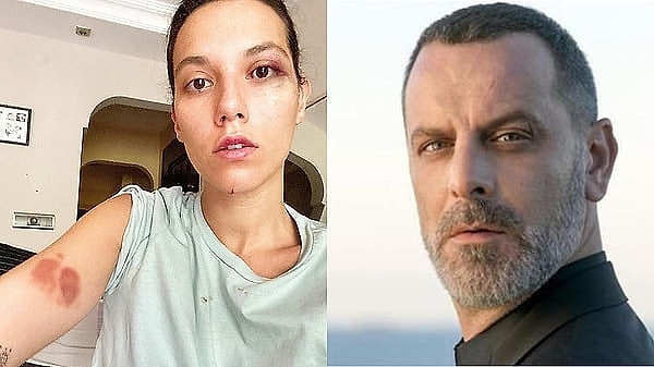 Eski sevgilisi Deniz Bulutsuz’a şiddet uyguladığı gerekçesiyle yargılandığı dava sonucunda 45 gün hapis yatacağı açıklanan Ozan Güven basın toplantısı düzenlemiş ve pişkin savunmasıyla pes dedirtmişti.