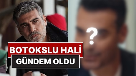 Saçlarını Boyatıp Dişlerini Yaptıran Caner Cindoruk'un Botokslu Son Halini Görenler Tanımakta Zorlandı!