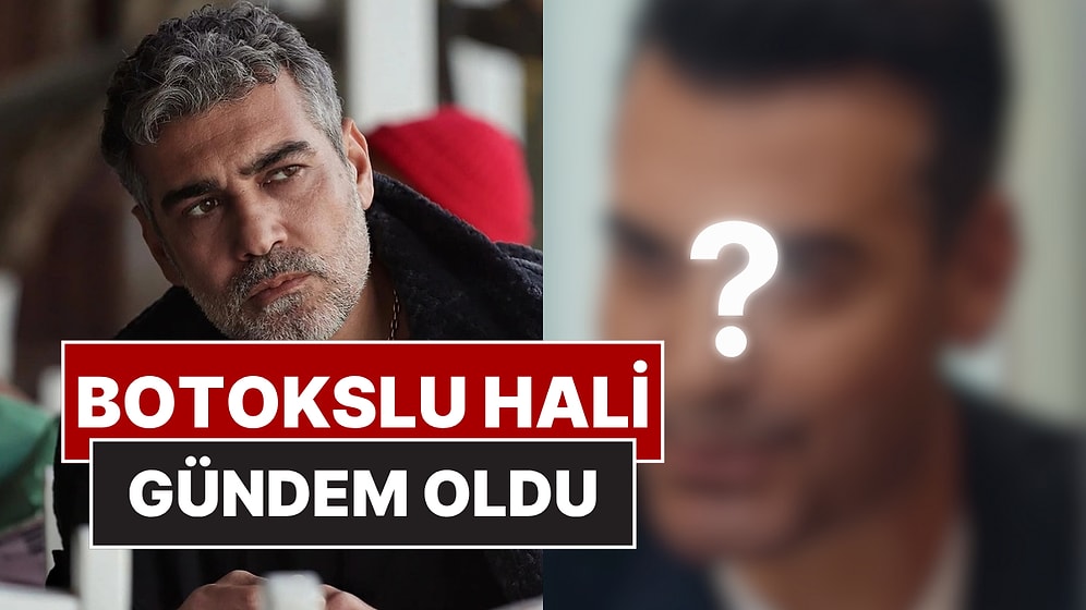 Saçlarını Boyatıp Dişlerini Yaptıran Caner Cindoruk'un Botokslu Son Halini Görenler Tanımakta Zorlandı!