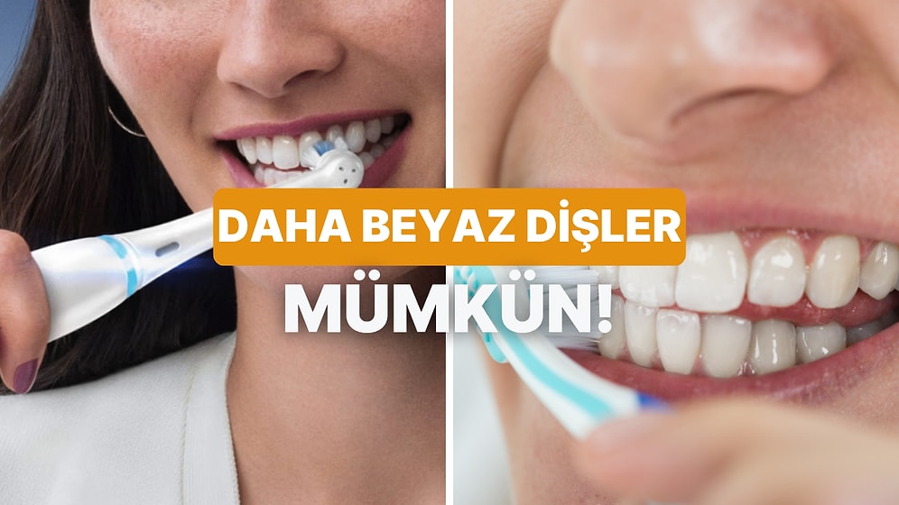 Daha Beyaz Dişlere Sahip Olmak İstiyorsanız Bu 10 İpucunu Değerlendirmelisiniz!