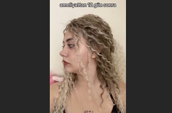 Devlet hastanelerinde estetik ücretsiz mi?