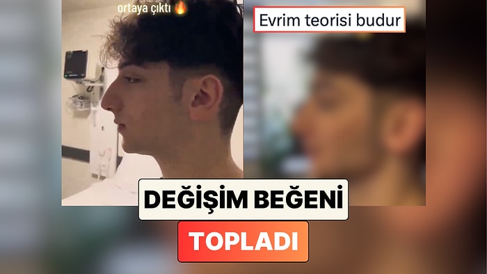 Bir Gencin Geçirdiği Burun Estetiği ile Yaşadığı Değişim Sosyal Medyada Viral Oldu