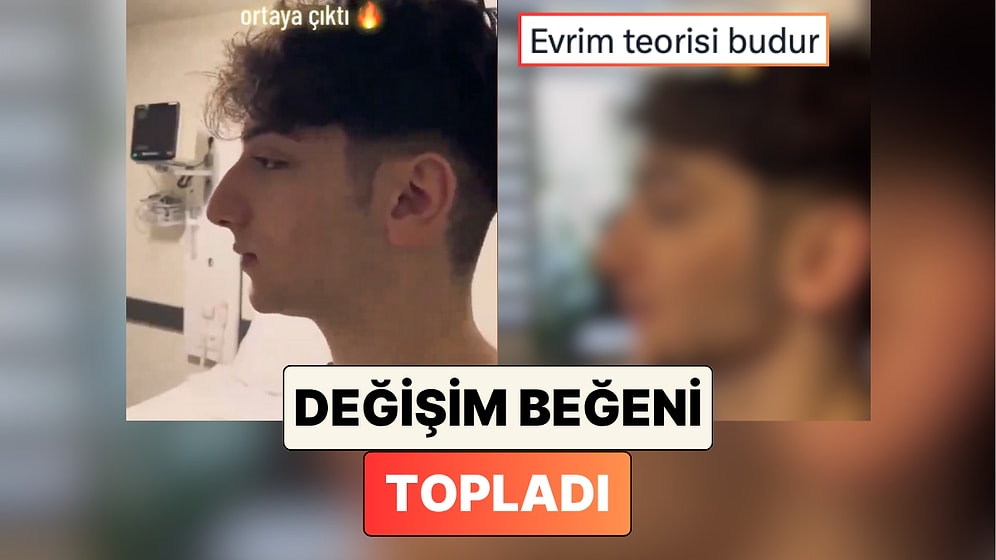 Bir Gencin Geçirdiği Burun Estetiği ile Yaşadığı Değişim Sosyal Medyada Viral Oldu