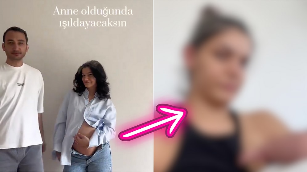 Hamileliği Sırasında "Anne Olduğunda Işıldayacaksın" Denilen Kadın Doğumdan Sonraki Halini Paylaştı