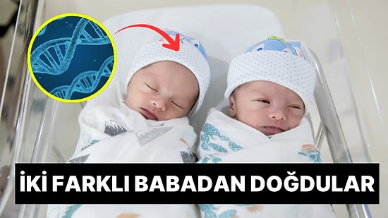 Tıp Dünyasını Hayretlere Düşüren Olay: Brezilya’da Doğan İkizlerin Farklı Babalardan Olduğu Ortaya Çıktı