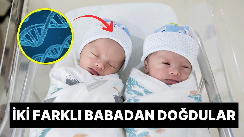Tıp Dünyasını Hayretlere Düşüren Olay: Brezilya’da Doğan İkizlerin Farklı Babalardan Olduğu Ortaya Çıktı