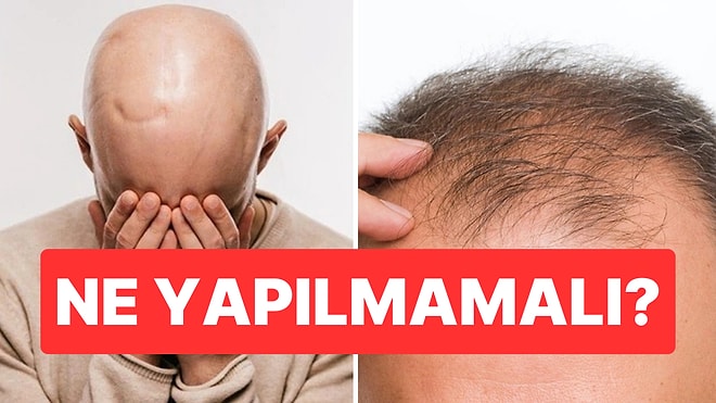 Uzman İsim Saç Dökülmesini Tetikleyen En Önemli Alışkanlığı Açıkladı
