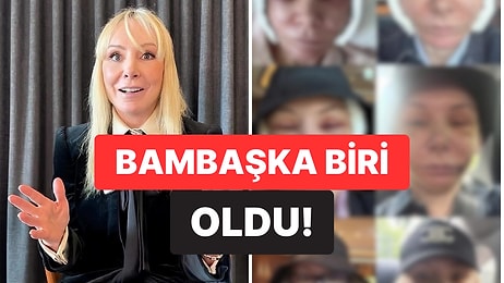 59 Yaşında ‘Jenner Estetiği’ İçin Kore’ye Gitti, Bambaşka Biri Oldu