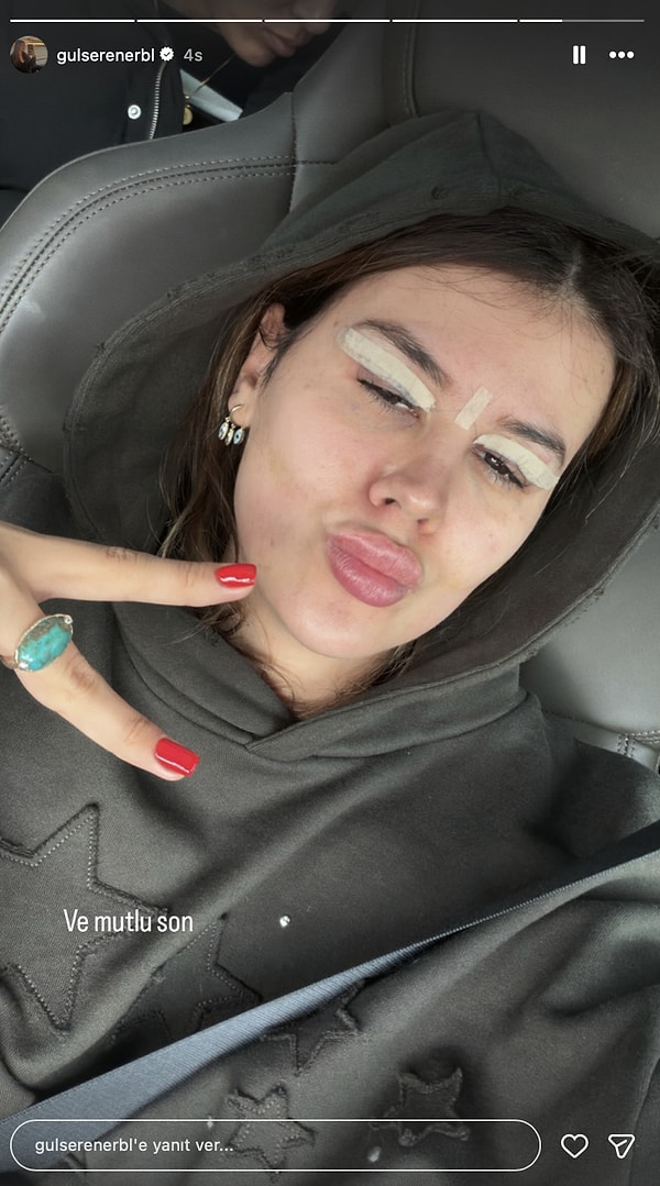 Sosyal medya hesabından bugün "küçük" bir operasyon geçireceğini duyuran Gülseren Ceylan göz kapaklarını aldırdı.