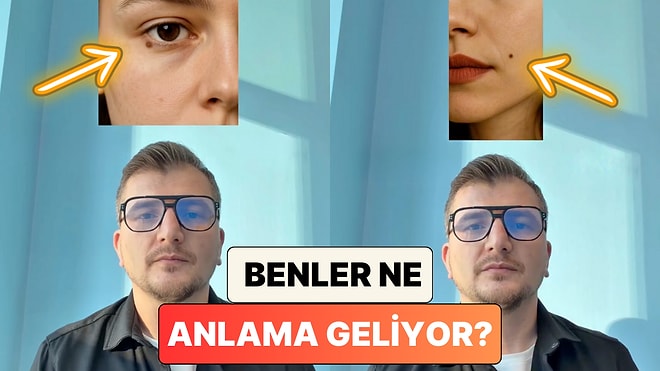Bir Fizyonomist Açıkladı: Vücudumuzdaki Benler Bulunduğu Yere Göre Ne Anlama Geliyor?