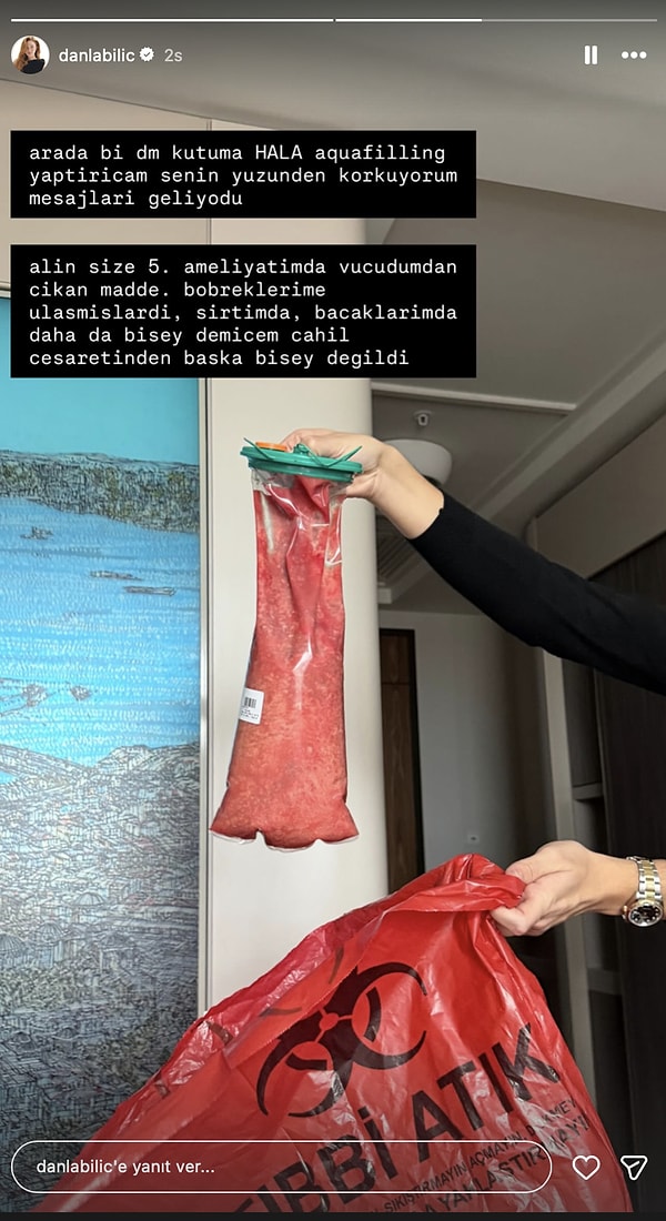 Danla Bilic, geçtiğimiz saatlerde temizleme ameliyatının beşincisine de girdiğini açıklayarak yeni bir fotoğraf paylaştı.