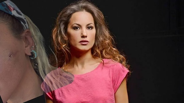 Bir dönemin efsane aile dizilerinde rol alan ve o dönem milyonların kalbini çalan Yıldız Asyalı, geçtiğimiz günlerde yaptığı paylaşımla korkutmuştu.