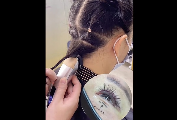 Hair is harvested and then implanted into the eyelashes and eyebrows.