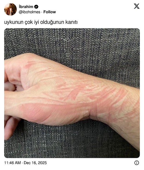 Suratın ortasında yastık izi de olmalı.