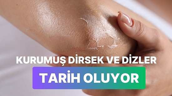 Soğuk Havada Kuruyan Dirsek ve Dizlere İyi Gelecek Bakım Ürünleri