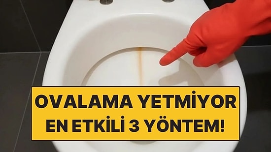 Sert Ovma Yetmiyor: Klozetteki İnatçı Sarı Lekeyi Anında Çıkaran 3 Yöntem!