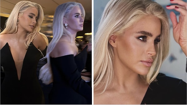 In recent years, Büşra Pekin has been frequently discussed in the entertainment news due to her aesthetic transformation and changes in her physical appearance.