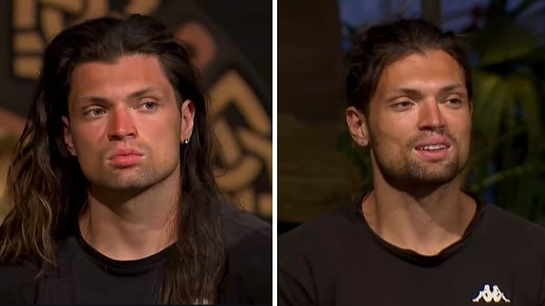 Gönüllüler'de yarışan ve sık sık güzel olmasıyla alakalı açıklamalar yapan Onur Alp, değişimiyle görenleri şoke etti.