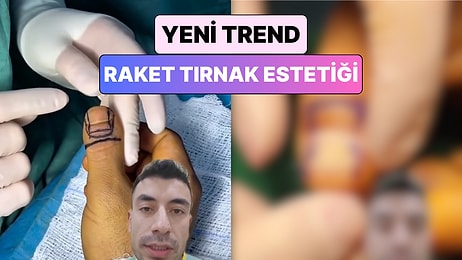 Estetik Çılgınlığına Bir Yenisi Daha Eklendi: Yeni Trend "Raket Tırnak Estetiği"