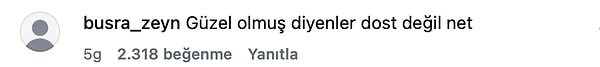 Yorumlarda, yapılan işlemin pek beğenilmediği dile getirildi.