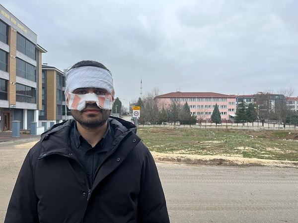 Yüzü yanan öğretmen o gün yaşananları şöyle anlattı.