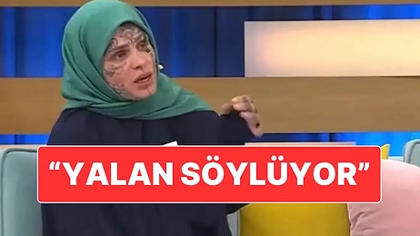 Yüzündeki Dövmelerle Gündem Olan Kadının Suçladığı Kişiden Cevap Geldi