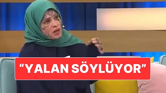 Yüzündeki Dövmelerle Gündem Olan Kadının Suçladığı Kişiden Cevap Geldi