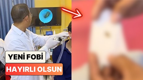 Yeni Fobi Oluştu: Kulak Ağrısı Şikayetiyle Doktora Giden Adamın Kulağından Böcek Çıktı