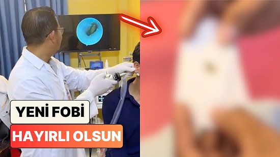 Yeni Fobi Oluştu: Kulak Ağrısı Şikayetiyle Doktora Giden Adamın Kulağından Böcek Çıktı