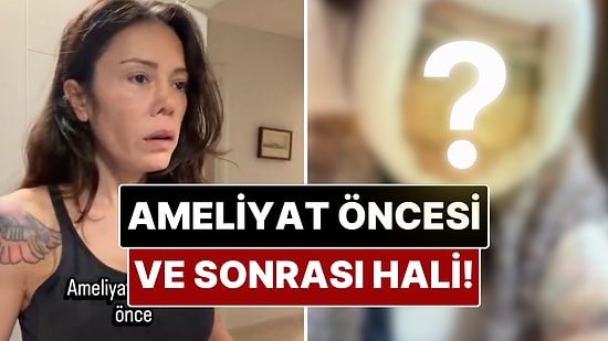 Eski Survivor Yarışmacısı Didem Ceran Estetik Ameliyatı Öncesi ve Sonrası Halini Paylaştı