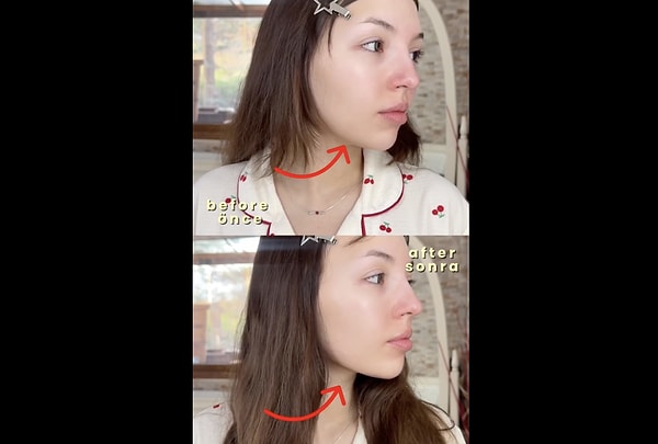 Videoda anlatılan bu yöntem, aslında geleneksel Çin tıbbındaki akupresür ve lenf drenajı prensiplerine dayanıyor. Bilimsel olarak "kesin bir mucize" olmasa da, geçici bir rahatlama ve görsel iyileşme sağlıyor.