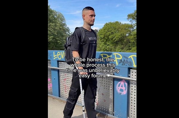 İlk olarak 2023 yılının başında üst bacak (uyluk) kemiğinden, ardından 2025 yılında alt bacak kemiğinden ameliyat olmuş. Toplamda yaklaşık 20 cm uzayarak 171 cm'den 191 cm'ye ulaşmış.