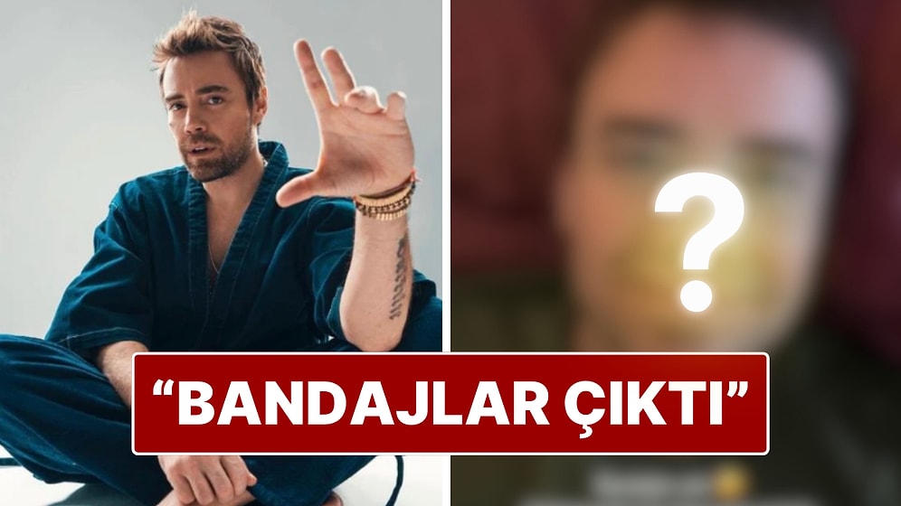Murat Dalkılıç 13. Ameliyat Sonrası Burnunun Son Halini Paylaştı