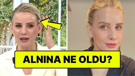 Alnındaki Yara Dikkat Çekmişti: Esra Erol Yüzünü Yaktığını Açıkladı