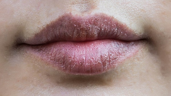 Kendini sakinleştirme çabası gibi görünse de zamanla döngüye dönüşebiliyor