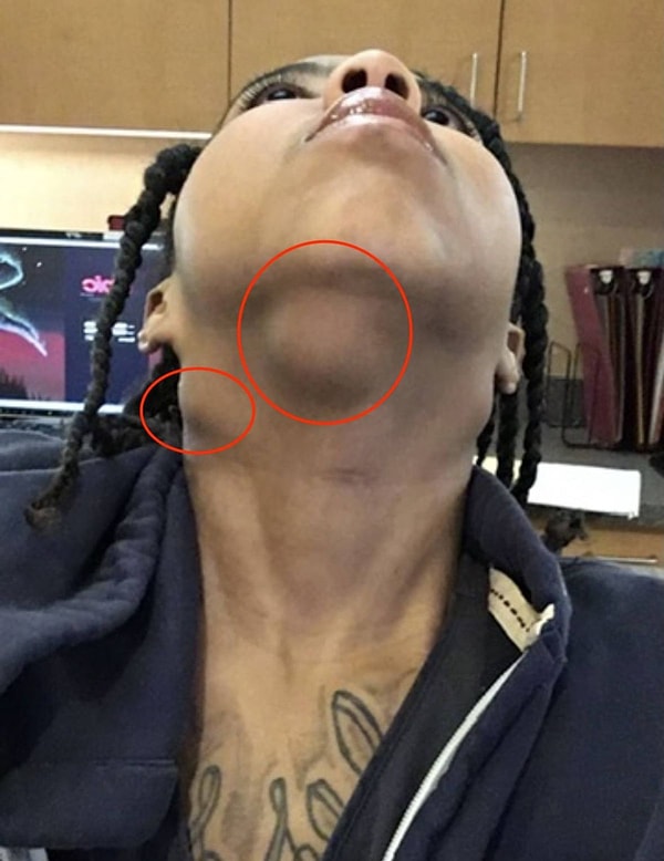 Smith, uygulanan tedavilere rağmen cilt sorunlarının hiçbir zaman düzelmediğini söylüyor.