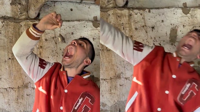 Man Bitten by Mouse After Trying to Put It in His Mouth for a Photo: A Viral Lesson on Wildlife Interaction