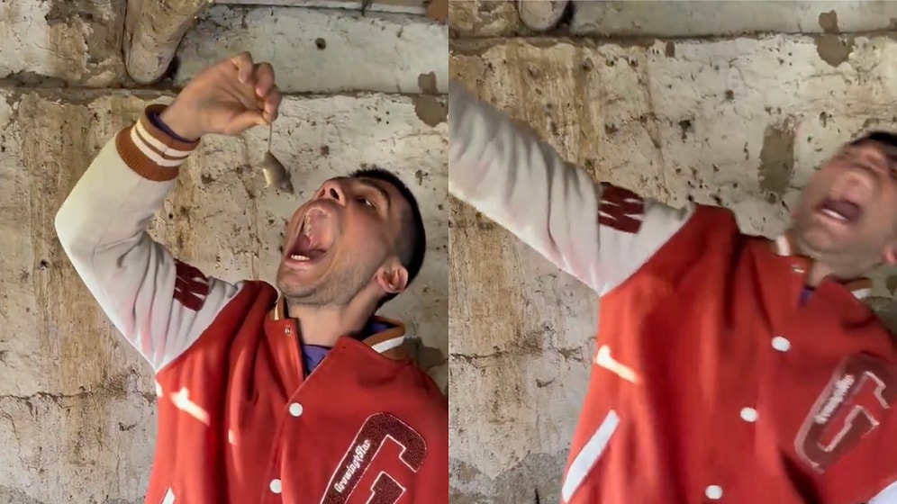 Man Bitten by Mouse After Trying to Put It in His Mouth for a Photo: A Viral Lesson on Wildlife Interaction