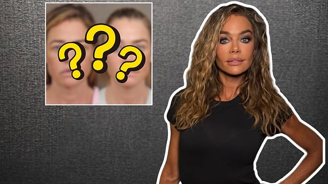 Denise Richards Reveals Drastic Transformation After Extensive Plastic Surgery Procedures