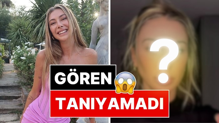 Şeyma Subaşı'nın Paylaştığı Son Videoda Yüzündeki Değişim Dikkat Çekti!