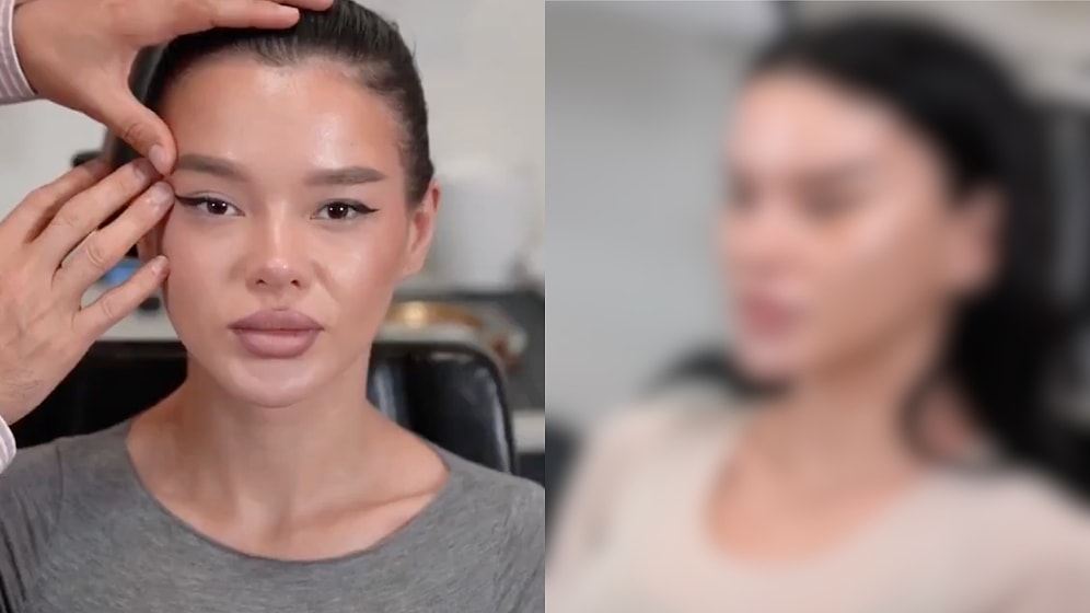 "Was It Really Necessary?" Woman's Almond Eye Surgery Sparks Huge Debate Online!