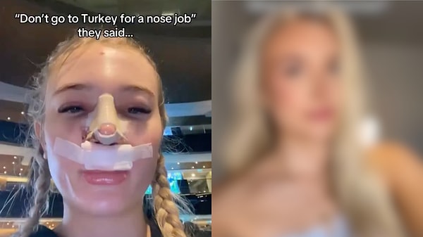 Woman Defies Warnings Over Rhinoplasty In Turkey