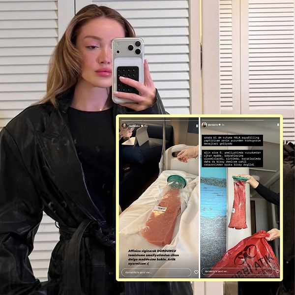 Sosyal medya fenomeni denince akla gelen ilk isimlerden Danla Bilic, son zamanlarda sık sık estetik süreciyle gündeme oturuyor.