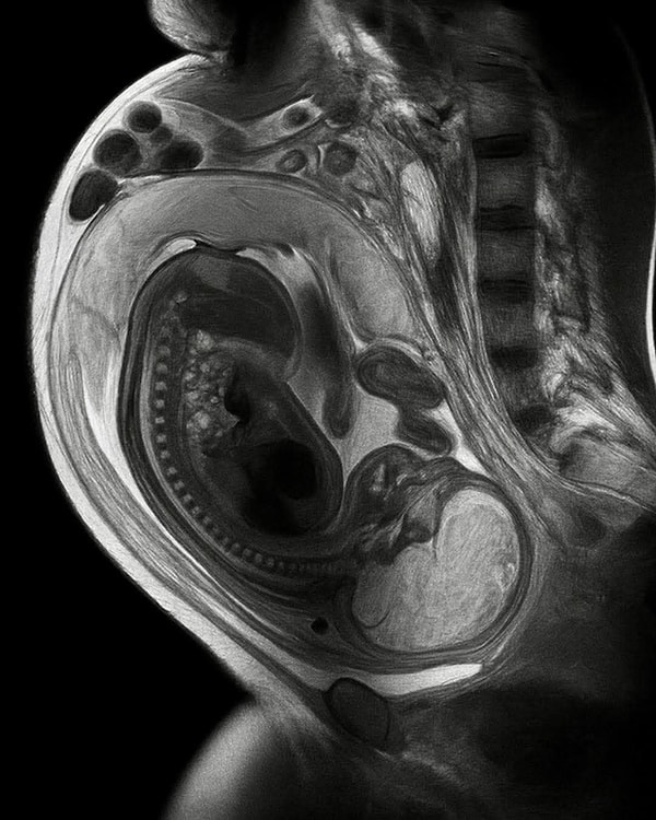 Anneden gelen hücreler biyolojik bir onarım mekanizması görevi görüyor.