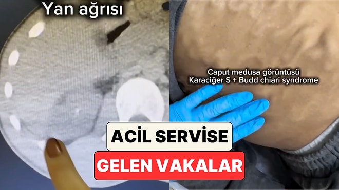 Acilde Görev Yapan Bir Doktor Gün Boyunca İlgilendiği Vakaları Paylaştı