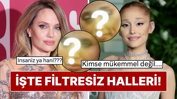 Filtresiz Görüntüleri Ortaya Çıktı: Ünlü İsimlerin Doğal Halleri Gündem Oldu!