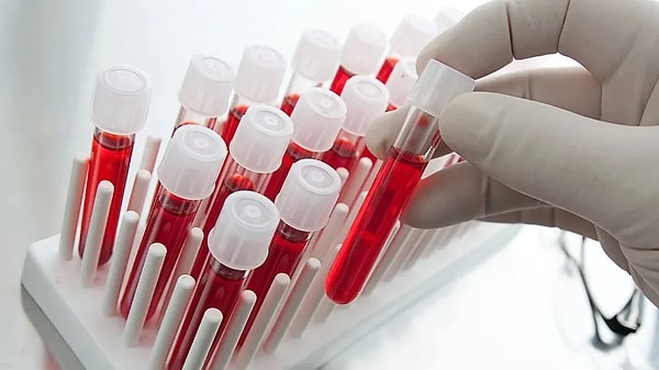 A kan grubu: Düzenli ve uyumlu