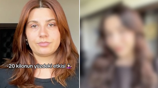 İngilizce: "Incredible Face Transformation: See How Losing 20kg Completely Redefined Her Features and Jawline!