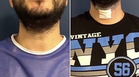 This Man’s Voice Deepening Surgery Went Viral! You Won't Believe the Difference in His New Deep Voice