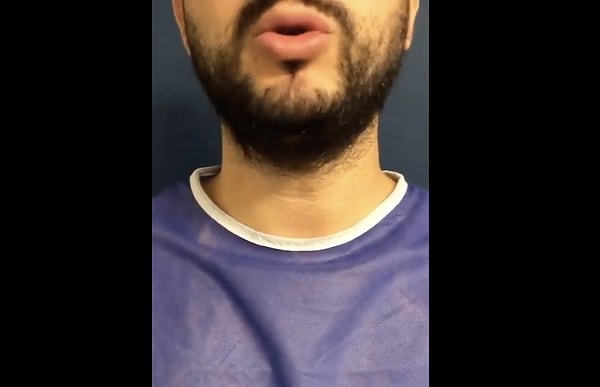 So, how is the voice deepening surgery performed?